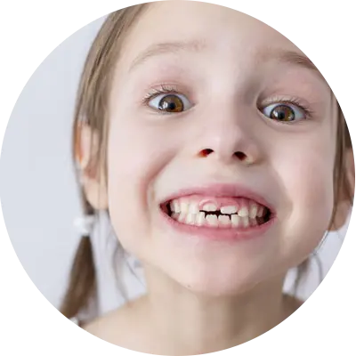 Ortodontia Infantil